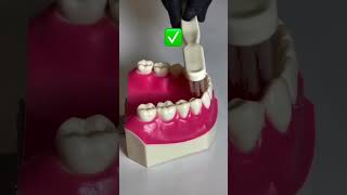 tooth teethcleaning toothbrush toothcare dental dentalcare dentalhealth teethwhitening [upl. by Aynekal]