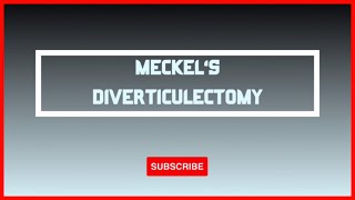 ETC 004 Laparoscopic Meckels Diverticulectomy [upl. by Mauceri]