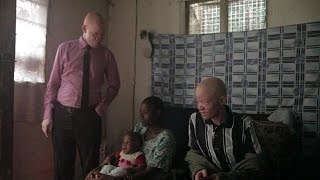 Albinos en Tanzanie une vie de stigmatisation [upl. by Ahsekyt]