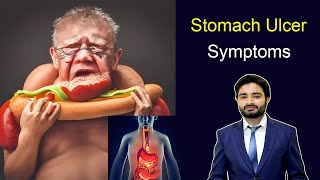 Stomach Ulcer Symptoms  peptic ulcer  Duodenum ulcer  Ulcer symptoms  medical videos  Doctor [upl. by Oriole]