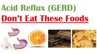 Worst Foods to Eat with Acid Reflux GERD Gastroesophageal Reflux Disease  How to Reduce Symptoms [upl. by Merwin]