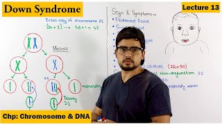 Downs Syndrome  A Genetic Disorder  Lecture 13 [upl. by Ennagem633]