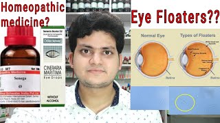 Eye Floaters Homeopathic medicine for Eye Floaters Explain [upl. by Keenan573]