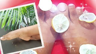 COMMENT SÉCLAIRCIR LES PIEDS  DES PIEDS SUPER CLAIRS FRAIS ET UNIFIÉS LE SECRET DE MA PEAU💖 [upl. by Nysa]