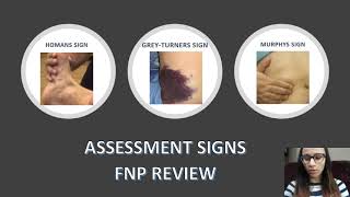 NP Board Review McBurney Cullens Psoas Lachman Homans Obturators McMurray Tinels sign [upl. by Lebbie]