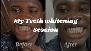 Got My Teeth Whitened to Level Up My Game 😎  Man’s Guide to First Impressions [upl. by Hogarth]