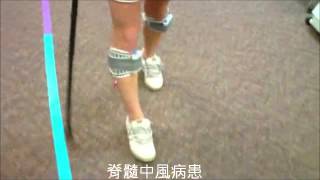 脊髓中風病患使用Walkaide Spinal Stroke using WalkAide [upl. by Walls]