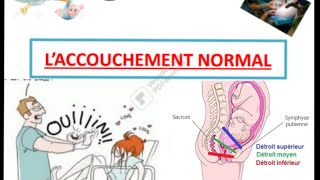 Accouchement normal  part 2 [upl. by Retsim819]