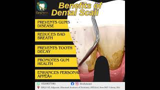 Benefits of Dental Scaling dentist teethimplants trending dentalwellbeing dentalscaling fypage [upl. by Solracsiul]