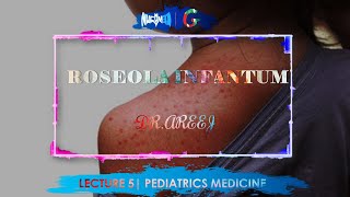 ROSEOLA INFANTUM  DrAREEJ  LECTURE 5 [upl. by Eeluj]