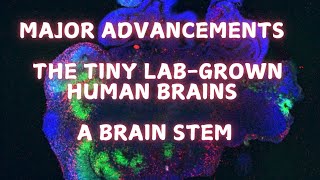 Giving the labgrown brains a brainstem [upl. by Yerfej821]