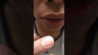 Putting salt on canker sore  mouth ulcer [upl. by Elleiand]