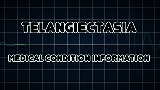 Telangiectasia Medical Condition [upl. by Janette218]