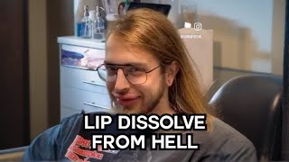 Lip Filler Dissolve Gone Wrong 😱  OKAY REALLY [upl. by Rolfston]