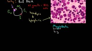 Macrocytic Anemia [upl. by Durarte]