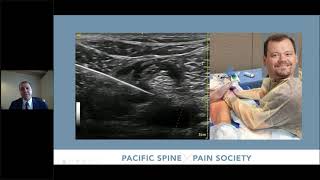 PSPS Training Webinar Series Session 1 Radiofrequency Techniques [upl. by Berti147]