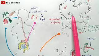 Angiostrongyliasis  Angiostrongylus cantonensis  Life cycle  Angiostrongylus costaricensis [upl. by Sined]