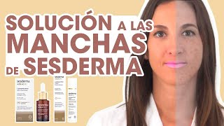 TRATAMIENTO ANTIMANCHAS Sesderma rostro libre de manchas solares I Al detalle [upl. by Nadruoj]