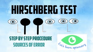 Hirschberg corneal reflex test [upl. by Aniarrol]