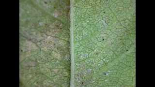 Two spotted spider mite Adults magnified 20X [upl. by Bethena957]