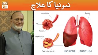 Pneumonia ka Ilaj  Syed Hakeem Abdul Basit [upl. by Asabi243]