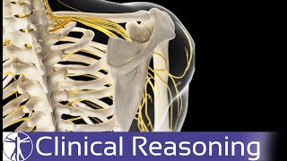 Does Your Patient Really Have Thoracic Outlet Syndrome TOS [upl. by Ecnerrot]