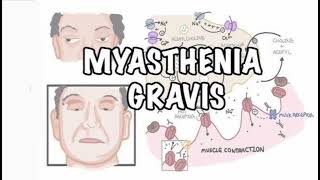 Myasthenia gravis History mrcpch Clinical [upl. by Burtie]