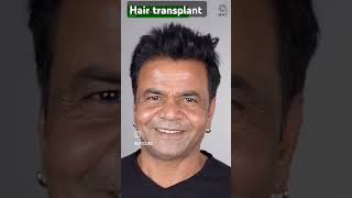 Rajpal Yadav hair bollywood actor love viralvideo daliy vlog SRK birthday Aishwarya Abhishek div [upl. by O'Grady]