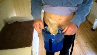 Emptying an ostomy bag using the Riksack from Stomaworks [upl. by Vanhook]