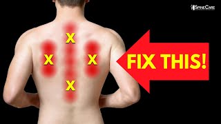 How to Instantly Relieve Nerve Pain in Your Upper Back [upl. by Olram]