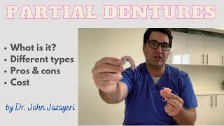 Partial Dentures Pros amp Cons  Cost  Different Types [upl. by Htehpaj200]