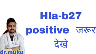 Hlab27 positive patient जरूर देखे  HLAB27 positive best treatment [upl. by Eelir]