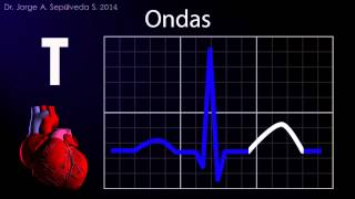 Electrocardiografía Básica Parte 14 [upl. by Briggs335]