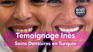 SOINS DENTAIRES  🦷 Témoignage 20 couronnes dentaires  BODYEXPERT [upl. by Ahseihs]