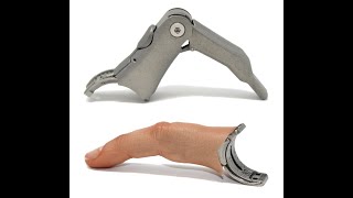 Point Endo Prosthetic Finger Function [upl. by Michaelina]