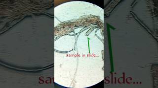 🔬Microscopic view of polysiphonia🧫🧬underthemicroscope MuskanSaraswat [upl. by Selia383]