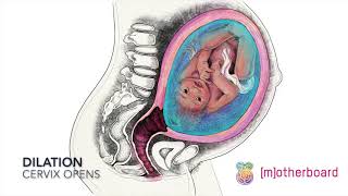 Effacement and Dilation [upl. by Paulina]