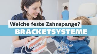 Feste Zahnspange  Bracketsysteme beim Kieferorthopäden  Welche Arten und Vorteile gibt es [upl. by Bogoch354]