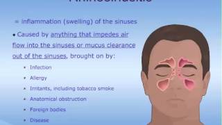 What are the Sinuses [upl. by Sweeney]