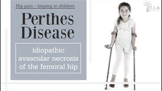 Perthes Disease LeggCalvePerthes Disease  nonsurgical treatment [upl. by Domineca888]