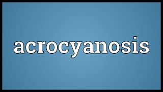 Acrocyanosis Meaning [upl. by Puduns]