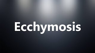 Ecchymosis  Medical Meaning and Pronunciation [upl. by Gile572]