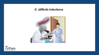 C difficile Infections [upl. by Icam]