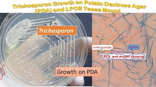 Trichosporon colony morphology on PDA and LPCB Mount Microscopy [upl. by Inahet338]