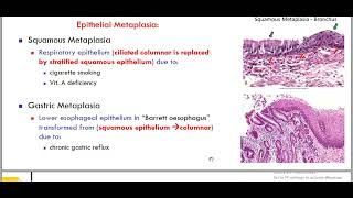 hypertrophy metaplasia [upl. by Ginnifer]