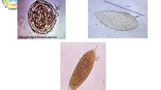 CBMBP Schistosoma2 lect [upl. by Ainwat501]