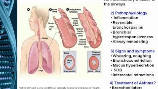 Asthma Pharmacogenomics 2010 [upl. by Okihsoy127]