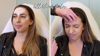 All About Botox 💉 Crows Feet Forehead 11 Before amp After Photos Does It Work Cost Review [upl. by Neyr]