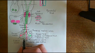 Amyotrophic Lateral Sclerosis ALS Part 4 [upl. by Oad]