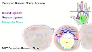 Dupuytren disease anatomy [upl. by Irpak699]